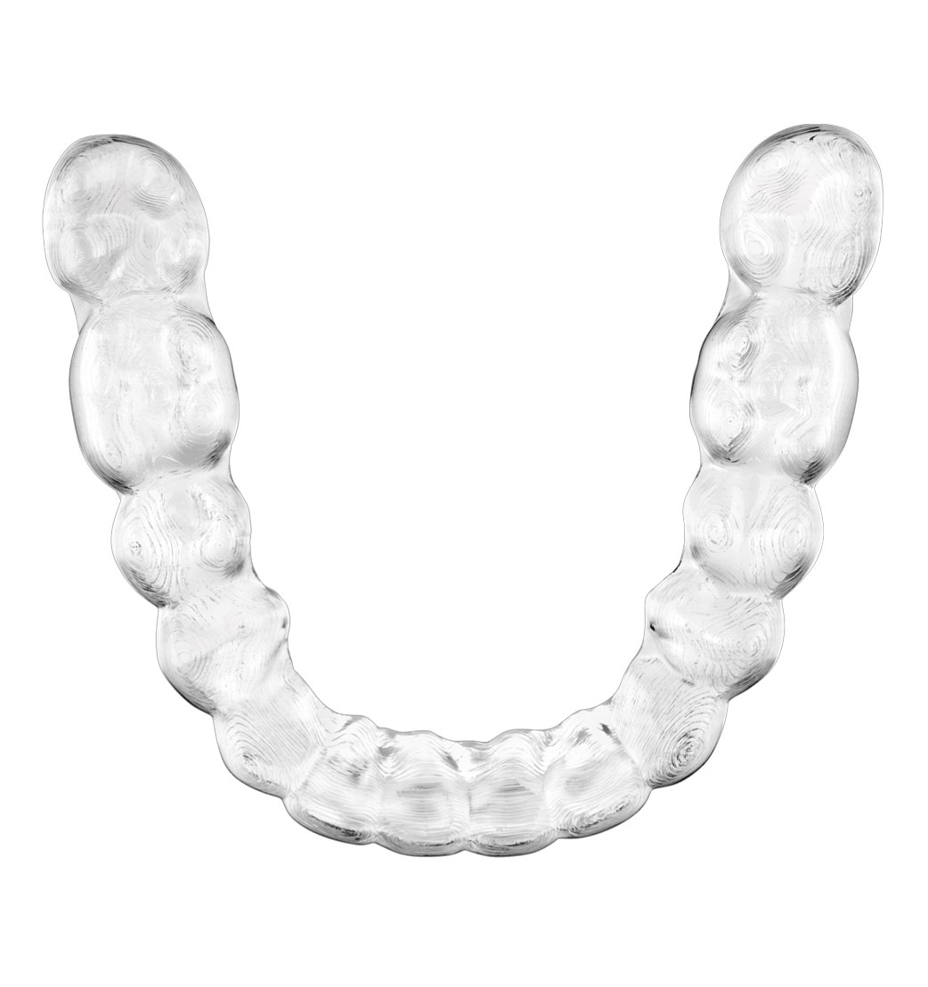 Aligner Tirol